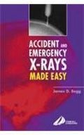 Accident and Emergency Xrays Made Easy, International Edition