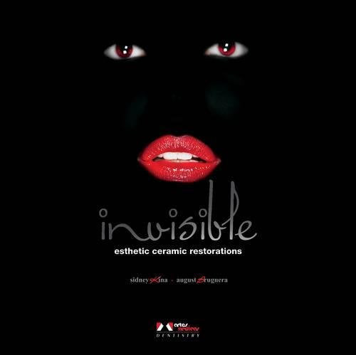 Invisible Esthetic Ceramic Restorations (Hb)