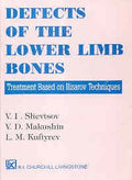 Defects Of The Lower Limb Bones