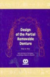 Design Of The Partial Removable Denture Step By Step (Hb 2008)