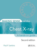 Making Sense of the Chest Xray: A handson guide