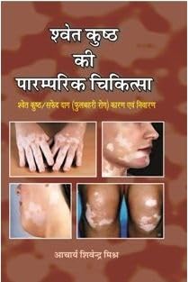 Shwet Kushtha Ki Paramparik Chikitsa |     