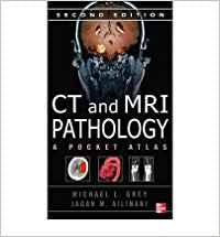 CT & MRI PATHOLOGY: A POCKET ATLAS(IE)