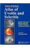 Sankara Nethralayas Atlas of Uveitis and Scleritis