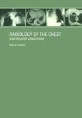 Radiology of the Chest and Related Conditions: Together with an extensive illustrative collection of radiographs, conventional a