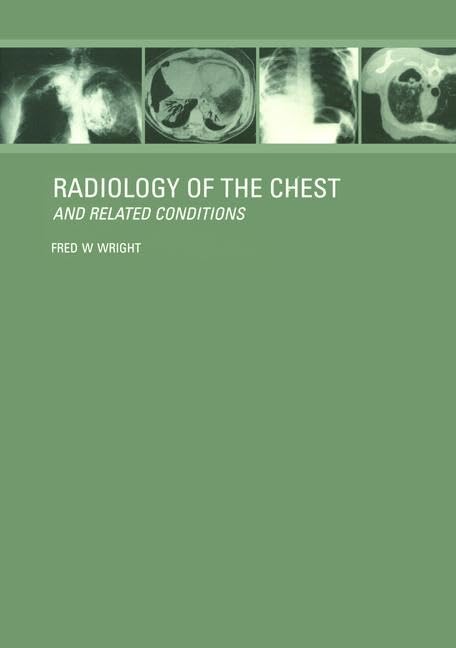 Radiology of the Chest and Related Conditions: Together with an extensive illustrative collection of radiographs, conventional a
