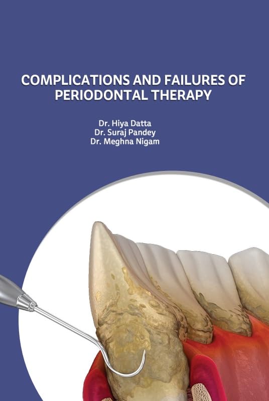 Failures and Complications of Periodontal Therapy
