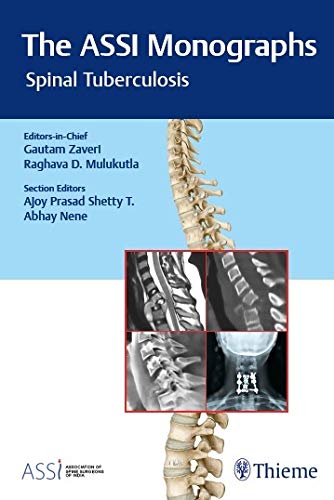 The ASSI MonographsSpinal Tuberculosis