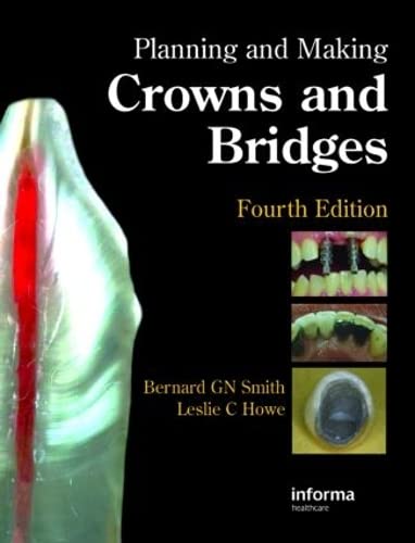 Planning And Making Crowns And Bridges