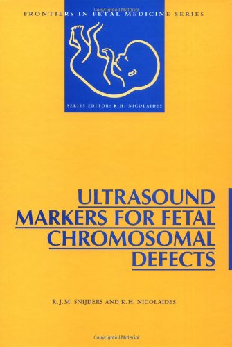 Ultrasound Markers for Fetal Chromosomal Defects (Frontiers in Fetal Medicine)