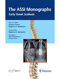 The ASSI MonographsEarly Onset Scoliosis