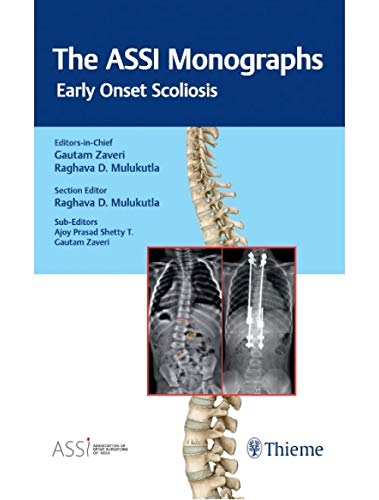 The ASSI MonographsEarly Onset Scoliosis
