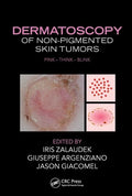 Dermatosocopy Of Non Pigmented Skin Tumors (Hb 2016): Pink  Think  Blink