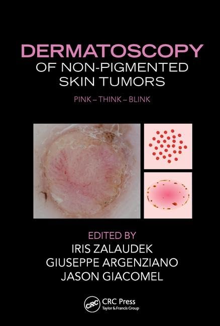 Dermatosocopy Of Non Pigmented Skin Tumors (Hb 2016): Pink  Think  Blink