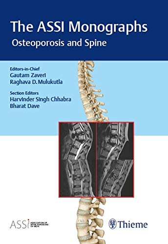 The ASSI Monographs  Osteoporosis and Spine