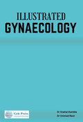 Illustrated Gynaecology