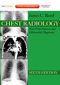Chest Radiology: Plain Film Patterns and Differential Diagnoses, Expert Consult  Online and Print