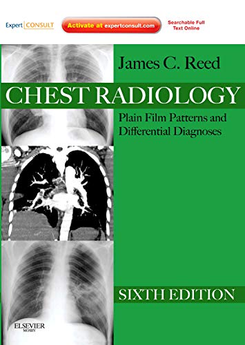 Chest Radiology: Plain Film Patterns and Differential Diagnoses, Expert Consult  Online and Print