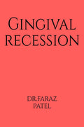 Gingival Recession