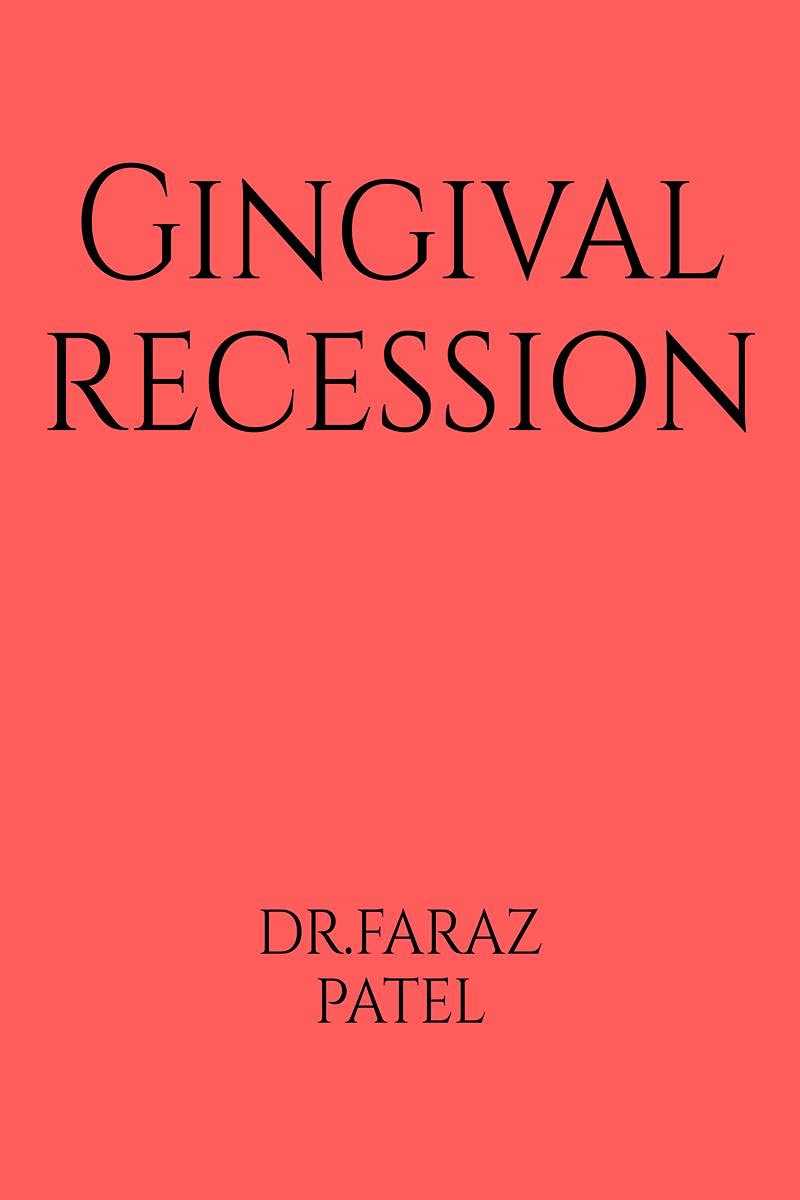 Gingival Recession