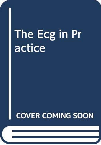 The Ecg in Practice