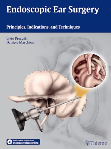 Endoscopic Ear Surgery: Principles, Indications and Techniques