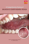 A Comprehensive Review Of Mukha & Sarvasara Roga