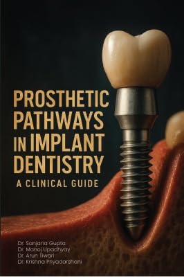 Prosthetic Pathways in Implant Dentistry: A Clinical Guide