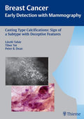 CastingType Calcifications: Sign of a Subtype with Deceptive Features (Tabar Mammo)
