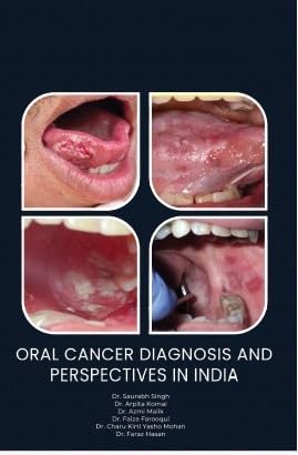 Oral Cancer Diagnosis And Perspectives In India