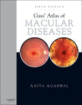 Gass Atlas of Macular Diseases: 2Volume Set  Expert Consult: Online and Print: 12