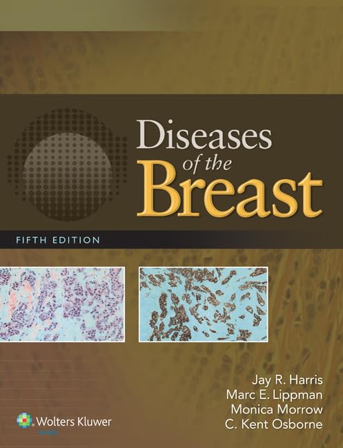 DISEASES OF THE BREAST