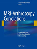MRIArthroscopy Correlations