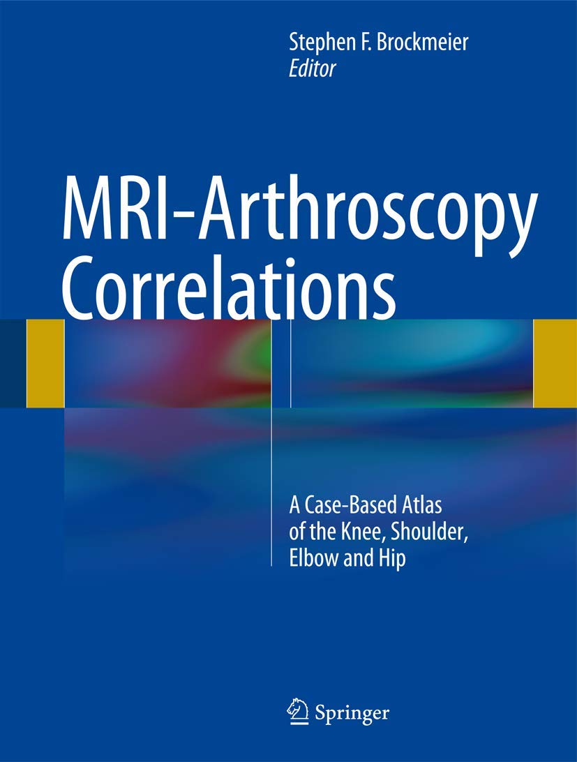 MRIArthroscopy Correlations