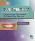 Tooth Whitening: Indications and Outcomes of Nightguard Vital Bleaching