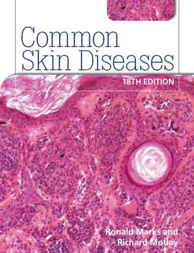 ROXBURGHS COMMON SKIN DISEASES(IE)