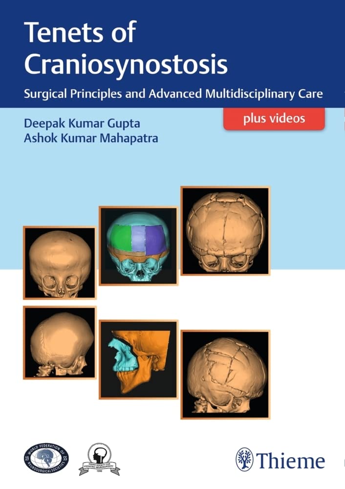 Tenets of Craniosynostosis: Surgical Principles and Advanced Multidisciplinary Care