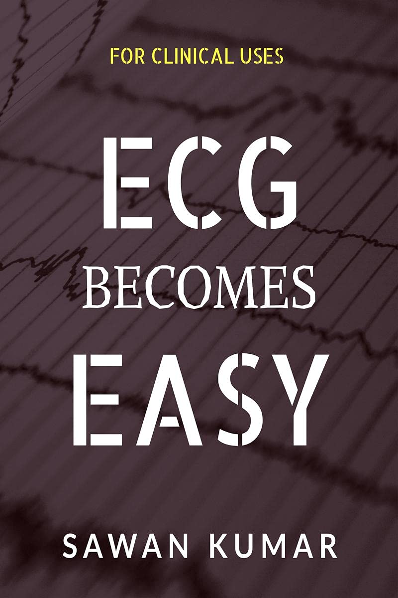 Ecg Becomes Easy