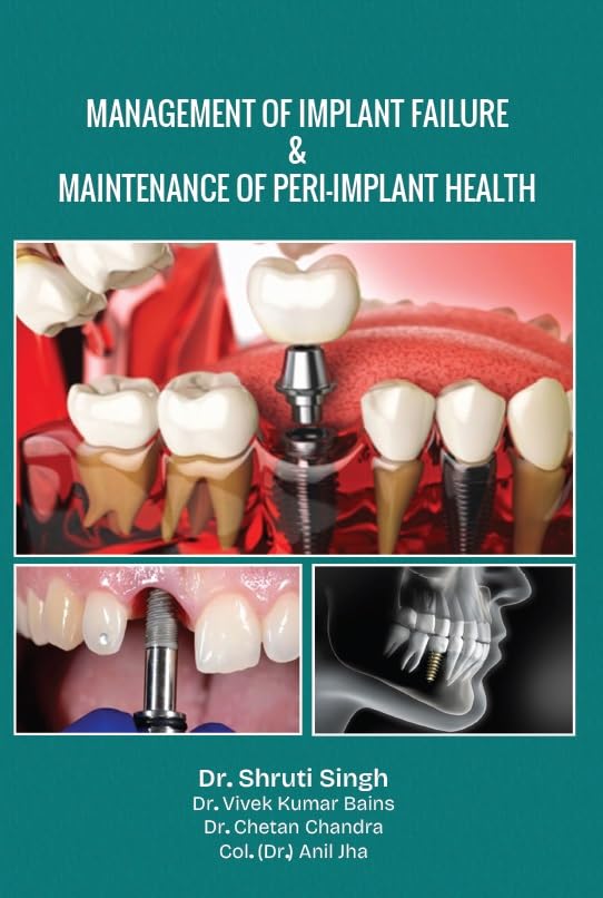Management Of Implant Failure & Maintenance Of PeriImplant Health
