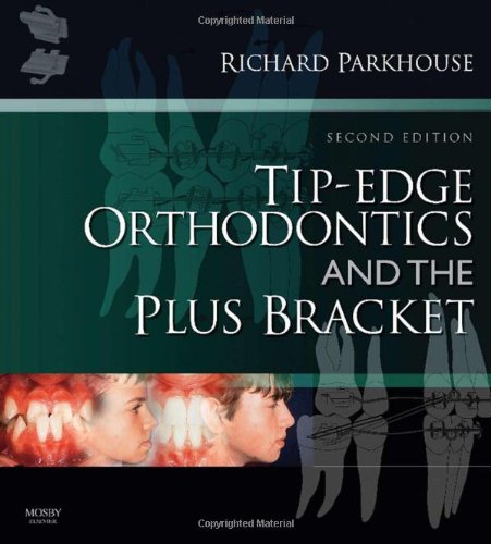 TipEdge Orthodontics and the Plus Bracket