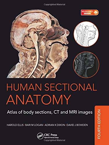 Human Sectional Anatomy Atlas Of Body Sections Ct And Mri Images With Access Code 4Ed (Hb 2015): Atlas Of Body Sections, Ct And 