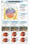 Stp18 | Teachingnest Eye And Its Defects Chart (58X90Cm) | English | Physics Charts [Wall Chart] Charts On Physics And Teachingn