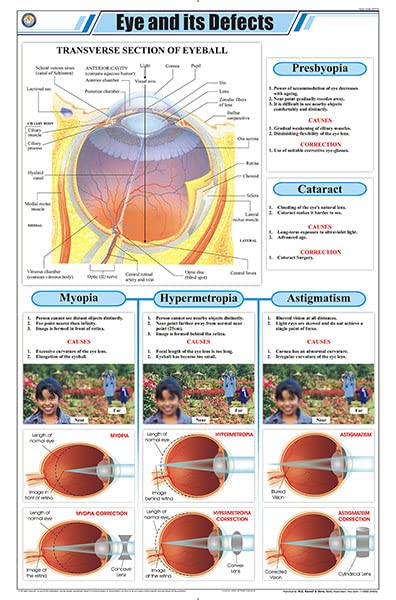 Stp18 | Teachingnest Eye And Its Defects Chart (58X90Cm) | English | Physics Charts [Wall Chart] Charts On Physics And Teachingn