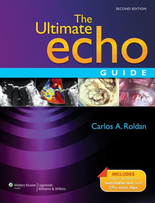 Ultimate Echo Guide