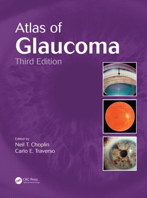 Atlas Of Glaucoma 3Ed (Hb 2014)