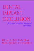 DENTAL IMPLANT OCCLUSION : OCCLUSION IN IMPLANT SUPPORTED PROSTHESIS