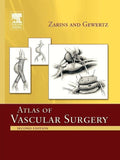 Atlas of Vascular Surgery  Paperback Edition
