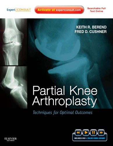 Partial Knee Arthroplasty: Techniques for Optimal Outcomes with DVD; Expert Consult  Online & Print