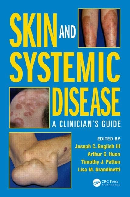 Skin and Systemic Disease: A Clinicians Guide