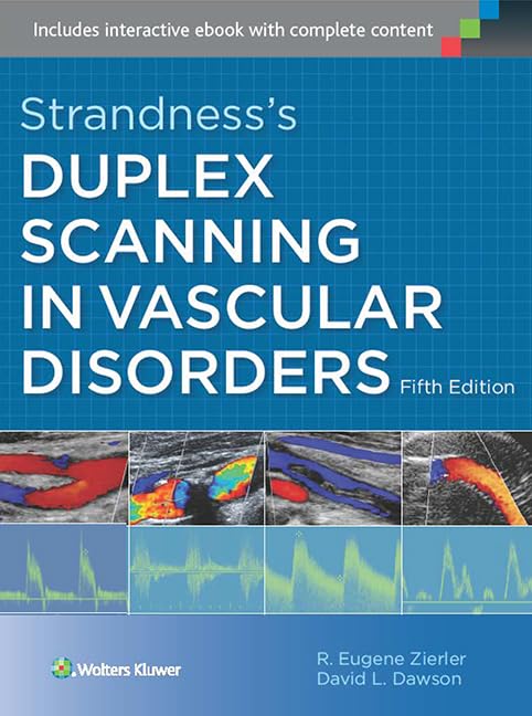 StrandnessS Duplex Scanning In Vascular Disorders